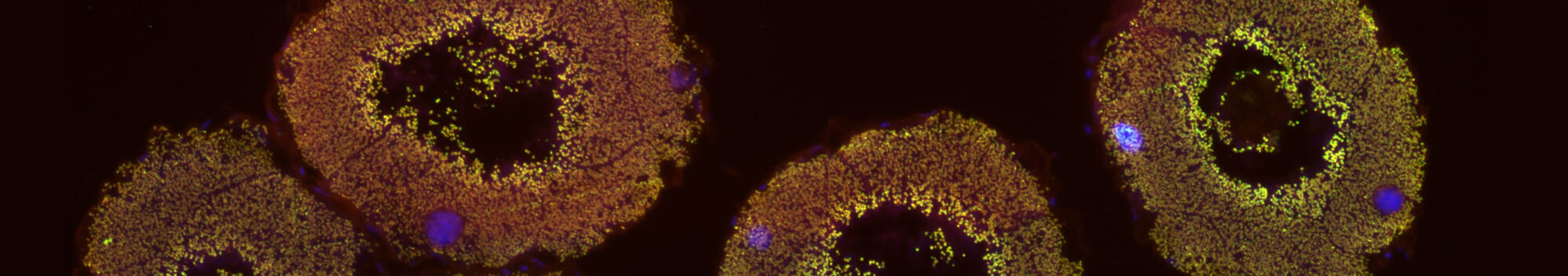 Donacia_vulgaris_symbiotic_organ © M.Kaltenpoth